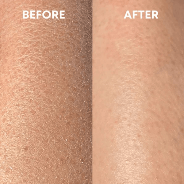 Strawberry Milkshake | Sheep Milk + Lactic Acid | Skin-Smoothing Dermal Milk Soak